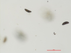 Xylaria schweinitzii