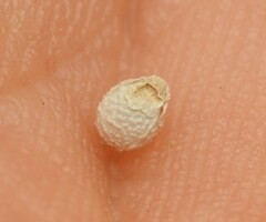 Scleria mackaviensis