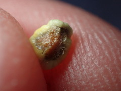 Cerococcus quercus