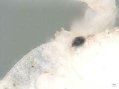 Androniscus dentiger