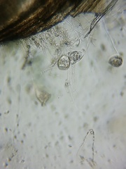 Sessilida