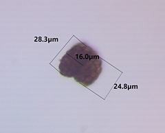 Berkleasmium conglobatum