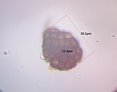 Berkleasmium conglobatum