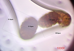 Berkleasmium conglobatum