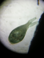 Stentor coeruleus