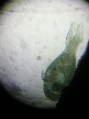Stentor coeruleus