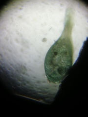 Stentor coeruleus