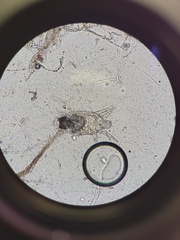Tyrophagus putrescentiae