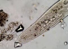 Anigsteinia clarissima