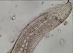 Anigsteinia clarissima