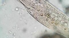 Anigsteinia clarissima