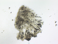 Mycocalicium subtile