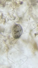 Stentor coeruleus
