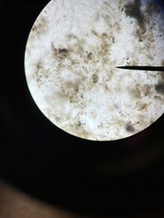 Stentor coeruleus