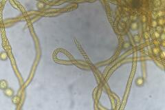 Oligonema verrucosum
