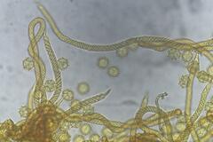 Oligonema verrucosum