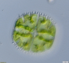 Micrasterias truncata