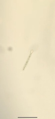 Anabaena