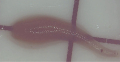 Helobdella