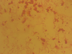 Azotobacter chroococcum