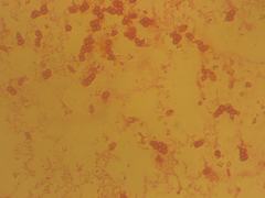 Azotobacter chroococcum