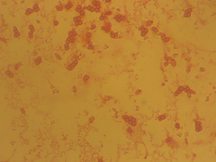 Azotobacter chroococcum