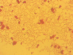 Azotobacter chroococcum