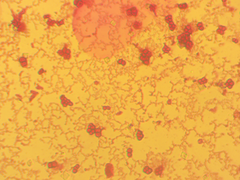 Azotobacter chroococcum