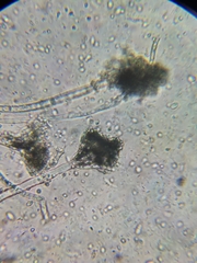 Aspergillus
