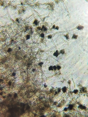 Aspergillus