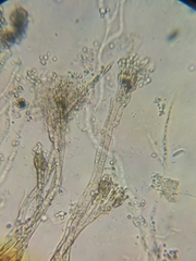 Aspergillus