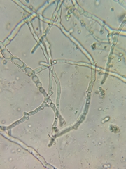 Aspergillus