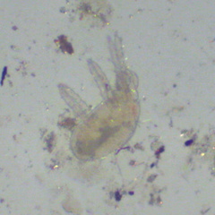 Entognatha