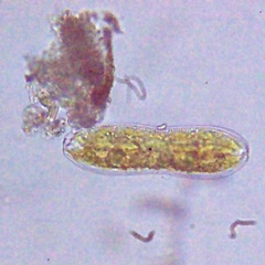 Surirella librile