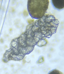Spiroplectamminoidea