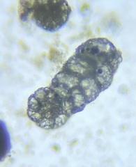 Spiroplectinella wrightii