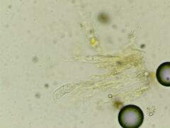 Dendrothele candida
