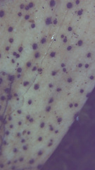 Leotiomycetes