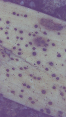 Leotiomycetes