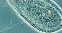 Kentrophyllum setigerum