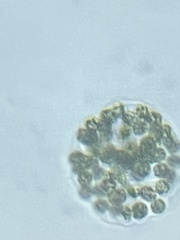 Coelastrum