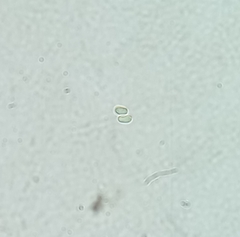 Leucoagaricus nympharum