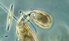 Campascus interstitialis