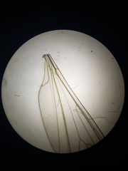 Trichocera