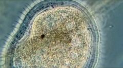 Kentrophyllum setigerum