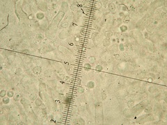 Tomentellopsis