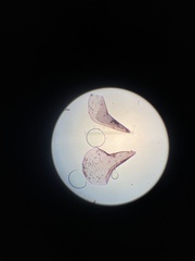 Sphagnum squarrosum