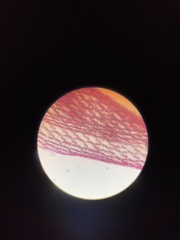 Sphagnum squarrosum