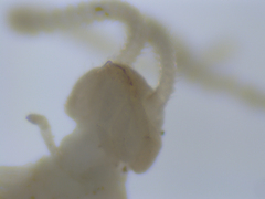 Symphyla