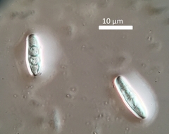 Cresponea chloroconia